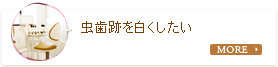 虫歯跡を白くしたい