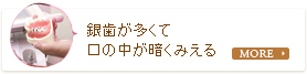 銀歯が多くて口の中が暗く見える