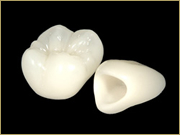 オールセラミック