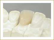 コンポジットレジン